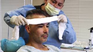 Bosley FUE Procedure Edgars Journey Hair Transplant  How Its Done [upl. by Reeva149]