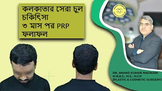 PRP Result  PRP Therapy for Hair Fall  PRP Treat stop hair fall in Kolkata  Hair Fall Solution [upl. by Okimuy923]