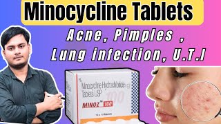 Minocycline Hydrochloride Tablets usp  Best Antibiotic For Acne amp Pimples  Benifit Of Minocycline [upl. by Rivers]