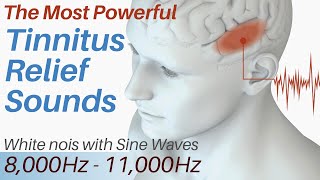 Tinnitus Relief Sounds  White Noise amp Sine Waves 8000Hz  11000Hz  Tinnitus Sound Therapy [upl. by Pius552]