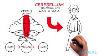 Neurology – Ataxia Gait – By Wendy Stewart MD [upl. by Marelda]