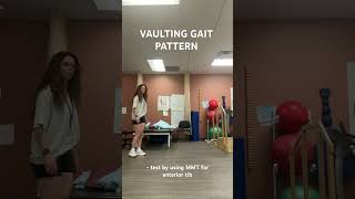 VAULTING GAIT PATTERN [upl. by Aicilaana710]