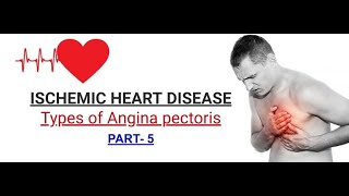 Ischemic Heart Disease  part5  Types of angina  HINDI [upl. by Berrie]