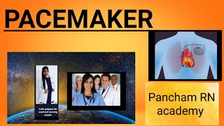 Pacemaker Nursing managementpancham RNacademy [upl. by Durr]