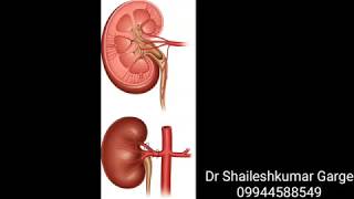 Embolisation of right renal artery branch  Coil Embolisation  Bleeding Embolisation in hyderabad [upl. by Assena]