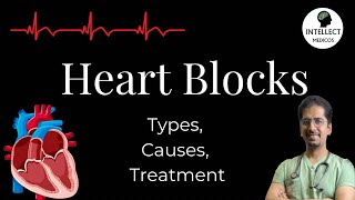 Heart Blocks Types Causes ECG findings Treatment [upl. by Naltiak]