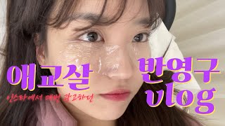 VLOG DAILY 필러💉맞기 무서워서 한 애교살 타투 후기😎 쌩얼주의 [upl. by Asher]