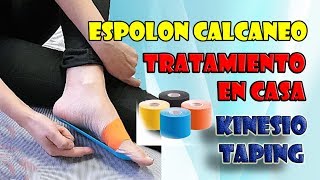 Tratamiento de espolón y fascitis plantar en casa con kinesio cinta [upl. by Yesnil]