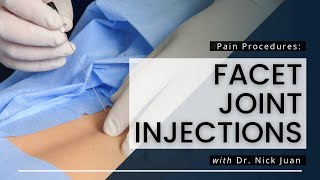 Facet Joint Injections What You Need To Know [upl. by Melony]