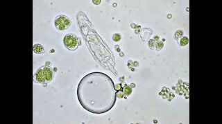 Algae Euglena 400x magnification [upl. by Tadich709]