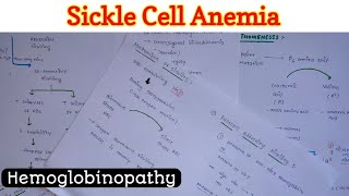 Sickle Cell Anemia [upl. by Laersi]