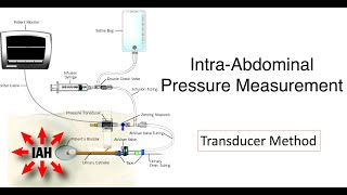 Intraabdominal Pressure Measurement II Cough Test for IAP II ICU Bedside Procedure [upl. by Leak649]