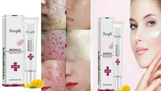 RtopR Mango Repair Acne Cream Anti Spots Acne Treatment Scar Blackhead Cream Shrink Pores Whitening [upl. by Nivac]