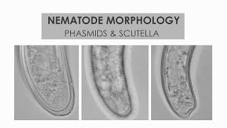 NEMATODE MORPHOLOGY PHASMIDS AND SCUTELLA [upl. by Bessy]