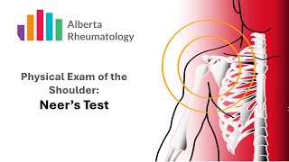 Neers Test Rheumatology Shoulder Physical Exam Special Tests [upl. by Klinges398]