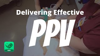 Delivering Effective PPV for Neonatal Resuscitation  NRP Mastery for Nurses [upl. by Ainod157]