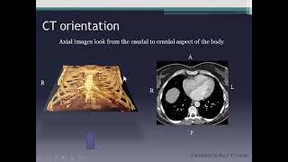 Cardiac CT anatomy [upl. by Haimes522]