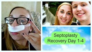 Septoplasty Recovery Day 14 [upl. by Galven572]