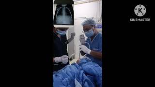 Esophagoscopy procedure to remove foreign bodyesophagoscopyRigid esophagoscopy [upl. by Noni]