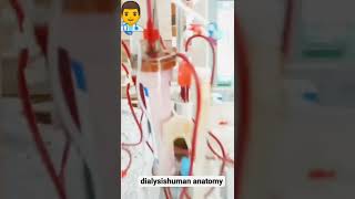 HEMODIALYSIS TREATMENTdialysis dialysishumananatomy [upl. by Winsor]