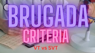 Brugada Criteria for VT vs SVT  2024 [upl. by Jaquith]