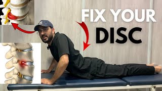 Herniated amp bulge disc excercises amp StretchesFix your Disc [upl. by Lizette]