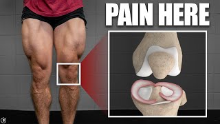 Meniscus Tear Rehab amp Exercises Stretching  Strength  Plyometrics [upl. by Iana336]