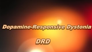 Dopamineresponsive dystonia [upl. by Elockcin]