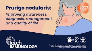 Prurigo nodularis Improving awareness diagnosis management and quality of life [upl. by Ludwigg]