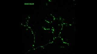 synaptopHluorin in live neurons [upl. by Nylareg]