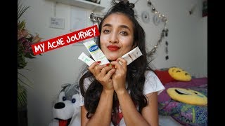 MY ACNE JOUREY  ISOTRETENOIN AND SELF LOVE [upl. by Arun370]