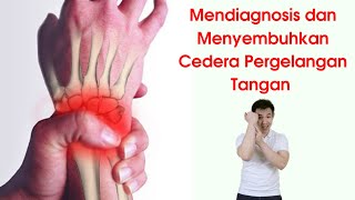 Cedera Pergelangan Tangan  Wrist  Cedera TFCC [upl. by Jocelyne]