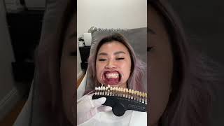 I Just Changed Teeth Whitening FOREVER [upl. by Oderfigis]