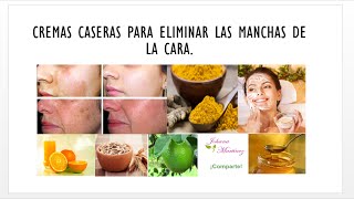 Cremas caseras para eliminar las manchas de la cara [upl. by Acinnod]