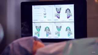 DePuy Synthes TRUMATCH CMF 2013  Video Production Branding [upl. by Lear492]