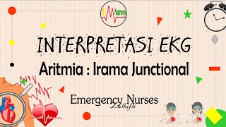 Junctional Rhythm ECG Rhythms [upl. by Stroud]