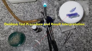 Oxidase Test Positive Procedure Result and Interpretation [upl. by Cicely768]