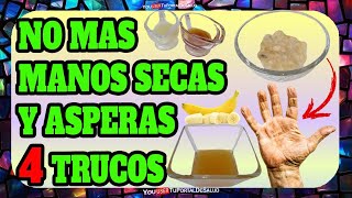 ¿Manos Secas y Ásperas ¡Prueba Estos 4 Trucos Caseros que Funcionan al Instante✅✅✅ [upl. by Ahsilad]