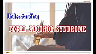 Fetal Alcohol Syndrome  Symptoms Characteristics Facial Features Statistics [upl. by Marnia]