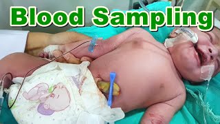 Blood Sampling in Newborn  Neonate Using Butterfly Line  Arterial Blood Sample  Baby  Paediatric [upl. by Decker342]