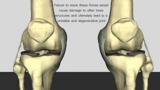 The Normal Function of the Anterior Cruciate Ligament [upl. by Lim796]