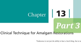 Clinical Technique for Amalgam Restorations part 3 Class 2 Amalgam Restorations Matrix and Wedges [upl. by Gnilsia860]