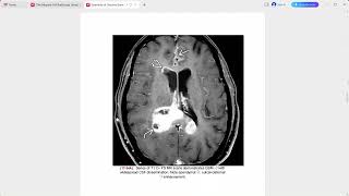 OSBORNE BRAIN IMAGING [upl. by Metah27]