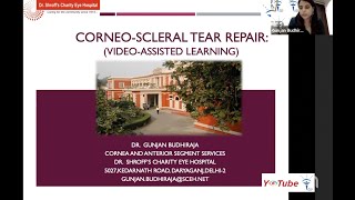 CorneoScleral Tear Repair Video Assisted  Dr Gunjan Budhiraja [upl. by Newol265]