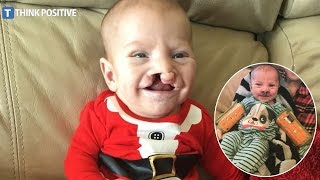 Mom Uplifted By Act Of Kindness After Hurtful Comment About Son’s Cleft Palate [upl. by Marillin]