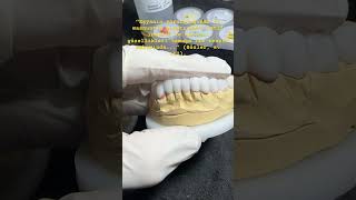 dentist dental orthodontist dentalclinic diş veneers reels dişteknisyeni emaxveneers [upl. by Dayiz]