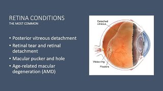 Demystifying Retinal Diseases [upl. by Amara396]