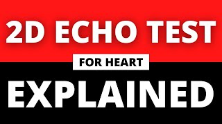 Heart 2D Echo Test Explained in English  2D Echo Test For Heart [upl. by Soirtimid]