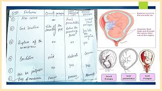 obstetrical emergency cord prolapse NGMedicals [upl. by Jenesia]