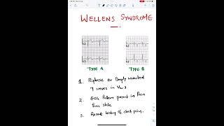 Wellens Syndrome  ECG [upl. by Akimak]